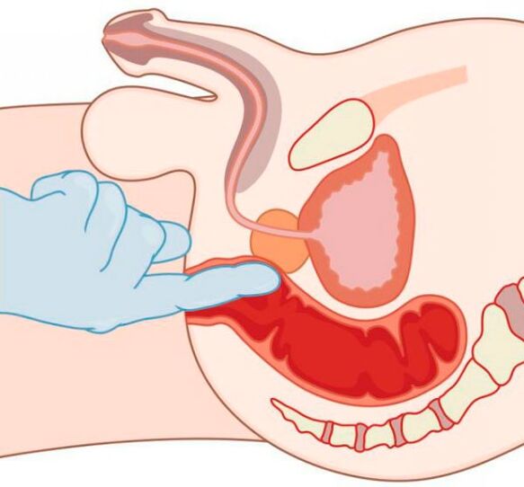 kích thích điểm G ở nam giới qua hậu môn